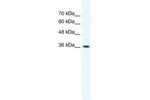 WB Suggested Anti-DVL1 Antibody Titration:  2. (DVL1 antibody  (Middle Region))