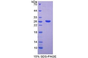 SDS-PAGE (SDS) image for ADAM Metallopeptidase Domain 8 (ADAM8) (AA 371-587) protein (His tag) (ABIN2123877) (ADAM8 Protein (AA 371-587) (His tag))