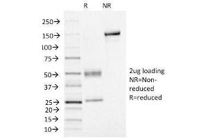 SDS-PAGE Analysis of Purified, BSA-Free FOXA1 Antibody (clone FOXA1/1515). (FOXA1 antibody  (AA 372-472))