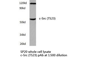 Western blot (WB) analyzes of c-Src antibody in extracts from SP20 cells.