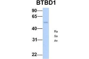 Host:  Rabbit  Target Name:  BTBD1  Sample Type:  Human Fetal Lung  Antibody Dilution:  1. (BTBD1 antibody  (N-Term))