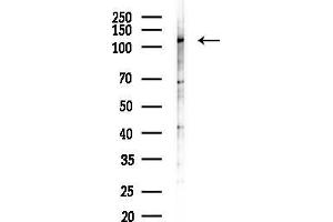 Western blot analysis of lysates from Rat lung, using LRRCC1 Antibody at 1/1000 dilution.