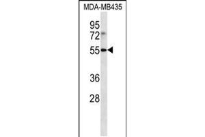 Western blot analysis in MDA-MB435 cell line lysates (35ug/lane). (LILRB4 antibody  (N-Term))