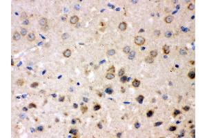 Anti- FE65 Picoband antibody, IHC(P) IHC(P): Mouse Brain Tissue (FE65 antibody  (N-Term))