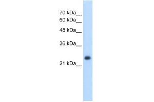 NNMT antibody used at 2. (NNMT antibody  (N-Term))