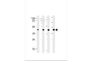 SRD5A3 Antibody (C-term) (ABIN651469 and ABIN2840258) western blot analysis in 293,LNCaP,PC-3,NCI- cell line lysates (35 μg/lane).