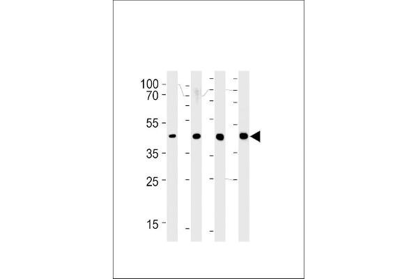 SRD5A3 antibody  (C-Term)