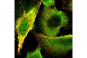 Immunofluorescent staining of U-251MG cell line with antibody shows positivity in nucleoplasm and cytosol (green).