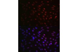 Immunofluorescence (IF) image for anti-Ribosomal Protein S6 Kinase, 70kDa, Polypeptide 1 (RPS6KB1) (pSer424), (pThr421) antibody (ABIN6136296)