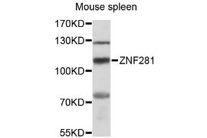 Western blot analysis of extracts of mouse spleen, using ZNF281 antibody (ABIN6291078) at 1:3000 dilution.