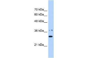 WB Suggested Anti-NMNAT1 Antibody Titration:  0. (NMNAT1 antibody  (N-Term))