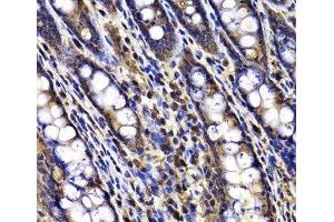 Immunohistochemistry of paraffin-embedded Rat ileum using ARID3A Polyclonal Antibody at dilution of 1:100 (40x lens). (ARID3A antibody)