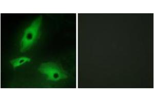 Immunofluorescence analysis of HeLa cells, using LTBR Antibody.
