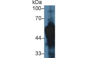 Western blot analysis of Rat Skin lysate, using Rat KRT14 Antibody (5 µg/ml) and HRP-conjugated Goat Anti-Rabbit antibody ( (KRT14 antibody  (AA 122-429))