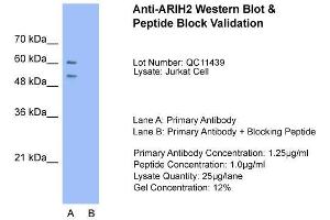 Jurkat; Host: Rabbit. (ARIH2 antibody  (N-Term))