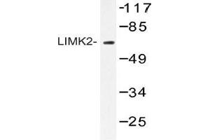 Western blot (WB) analysis of AP20423PU-N LIMK2 antibody in extracts from HepG2 cells. (LIMK2 antibody)
