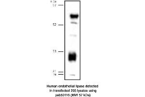 Image no. 1 for anti-Lipase, Endothelial (LIPG) (C-Term) antibody (ABIN363425) (LIPG antibody  (C-Term))