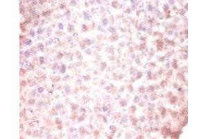 Immunohistochemistry of paraffin-embedded mouse liver tissue using ABIN7147238 at dilution of 1:100 (CDKN2AIPNL antibody  (N-Term))