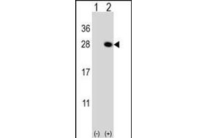 Western Blotting (WB) image for anti-Quinoid Dihydropteridine Reductase (QDPR) (AA 218-243), (C-Term) antibody (ABIN652787)
