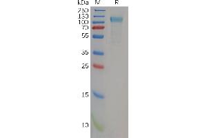 SDS-PAGE (SDS) image for Toll-Like Receptor 3 (TLR3) (AA 28-80) protein (His tag) (ABIN7092737)