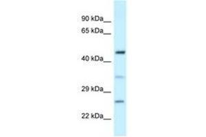 Image no. 1 for anti-Mediator Complex Subunit 18 (MED18) (AA 82-131) antibody (ABIN6747688) (MED18 antibody  (AA 82-131))