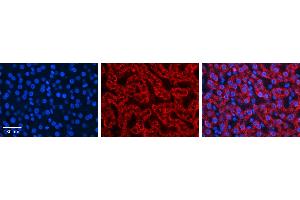 HADH antibody - C-terminal region (ARP54765_P050) Catalog Number: ARP54765_P050  Formalin Fixed Paraffin Embedded Tissue: Human Liver Tissue  Observed Staining: Cytoplasm in mitochondria of hepatocytes Primary Antibody Concentration: 1:600  Secondary Antibody: Donkey anti-Rabbit-Cy3  Secondary Antibody Concentration: 1:200  Magnification: 20X  Exposure Time: 0. (HADH antibody  (C-Term))