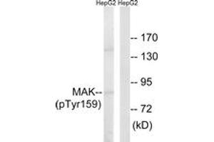 Western blot analysis of extracts from HepG2 cells treated with PMA 125ng/ml 30', using MAK (Phospho-Tyr159) Antibody. (MAK antibody  (pTyr159))