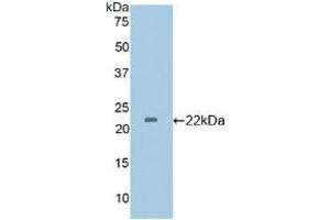Detection of Recombinant GP4, Mouse using Polyclonal Antibody to Cluster Of Differentiation 36 (CD36) (CD36 antibody  (AA 45-203))