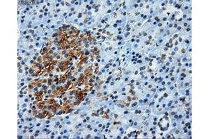 Immunohistochemical staining of paraffin-embedded liver tissue using anti-ATP5Bmouse monoclonal antibody.