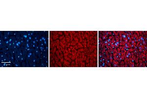Rabbit Anti-TXN2 Antibody Catalog Number: ARP54910_P050 Formalin Fixed Paraffin Embedded Tissue: Human heart Tissue Observed Staining: Cytoplasmic Primary Antibody Concentration: N/A Other Working Concentrations: 1:600 Secondary Antibody: Donkey anti-Rabbit-Cy3 Secondary Antibody Concentration: 1:200 Magnification: 20X Exposure Time: 0. (TXN2 antibody  (Middle Region))