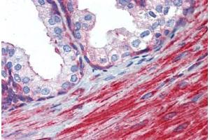 Prostate, Human: Formalin-Fixed, Paraffin-Embedded (FFPE) (MYL6 antibody  (AA 72-121))