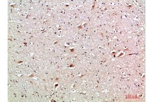 Immunohistochemical analysis of paraffin-embedded human-brain, antibody was diluted at 1:200 (CD137 antibody  (AA 111-160))
