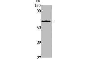 anti-Cytochrome P450, Family 2, Subfamily A, Polypeptide 6 (CYP2A6) (Internal Region) antibody