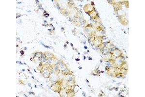 Immunohistochemistry of paraffin-embedded Human stomach using IFNL3 Polyclonal Antibody at dilution of 1:100 (40x lens). (IL28B antibody)