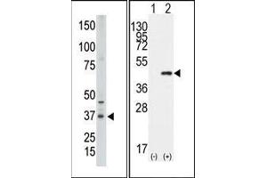 Image no. 1 for anti-Caudal Type Homeobox 2 (CDX2) (N-Term) antibody (ABIN358610)
