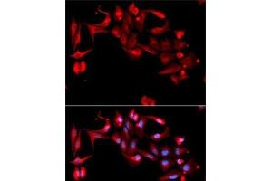Immunofluorescence analysis of A-549 cells using GP9 Polyclonal Antibody (CD42a antibody)