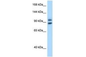 Image no. 1 for anti-Zinc Fingers and Homeoboxes 1 (ZHX1) (AA 32-81) antibody (ABIN6748029)