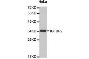 Western Blotting (WB) image for anti-Insulin-Like Growth Factor Binding Protein 2, 36kDa (IGFBP2) antibody (ABIN2650925) (IGFBP2 antibody)