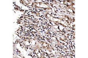 IHC analysis of IFI16 using anti-IFI16 antibody (ABIN7600374). (IFI16 antibody  (AA 183-743))