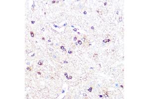 Immunohistochemistry of paraffin-embedded mouse spinal cord using IDO1 Rabbit mAb (ABIN7267863) at dilution of 1:100 (40x lens). (IDO1 antibody)