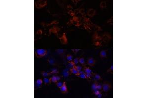 Immunofluorescence analysis of NIH/3T3 cells using STXBP1 antibody (ABIN6128255, ABIN6148673, ABIN6148674 and ABIN6221073) at dilution of 1:100 (40x lens). (STXBP1 antibody  (AA 295-594))