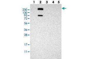 Western blot analysis of Lane 1: RT-4, Lane 2: U-251 MG, Lane 3: Human Plasma, Lane 4: Liver, Lane 5: Tonsil with MPDZ polyclonal antibody . (MPDZ antibody)