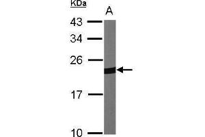 Peroxiredoxin 1 antibody