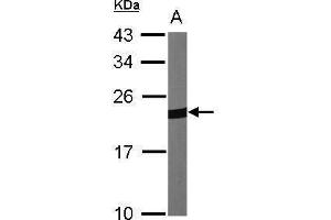 WB Image Sample (30 ug of whole cell lysate) A:NIH-3T3 12% SDS PAGE antibody diluted at 1:1000 (Peroxiredoxin 1 antibody)