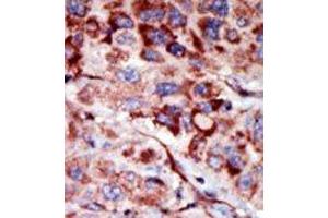 Image no. 2 for anti-Adenylate Kinase 2 (AK2) (C-Term) antibody (ABIN360625) (Adenylate Kinase 2 antibody  (C-Term))