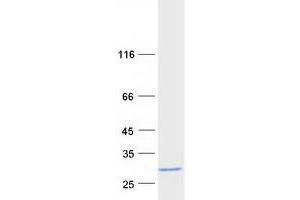 Western Blotting (WB) image for Synuclein, beta (SNCB) (Transcript Variant 1) protein (Myc-DYKDDDDK Tag) (ABIN2715251)
