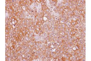 IHC-P Image Immunohistochemical analysis of paraffin-embedded BT474 xenograft, using AHCYL2, antibody at 1:100 dilution. (AHCYL2 antibody)