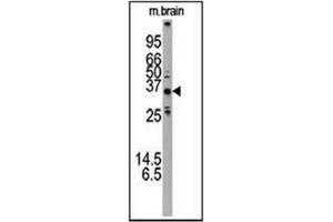 Western blot analysis using ATG5 Antibody (N-term) Cat. (ATG5 antibody  (N-Term))