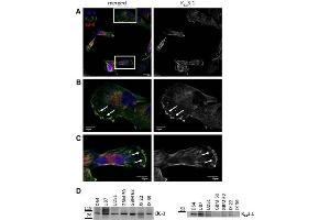 Colocalization and expression of KCa3.