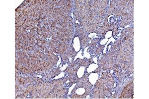 IHC analysis of PDIA6 using anti-PDIA6 antibody (ABIN7600553). (PDIA6 antibody  (AA 20-440))